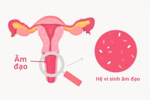 Men vi sinh phụ khoa là những lợi khuẩn giúp âm đạo khỏe mạnh