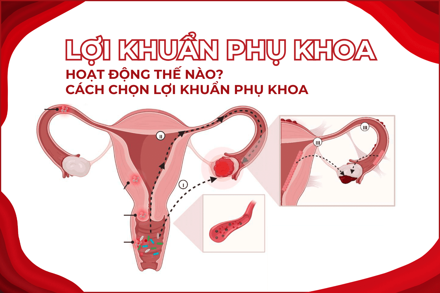 Lợi khuẩn phụ khoa