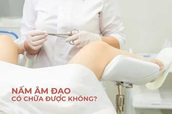 Nên phát hiện sớm nấm âm đạo để chữa trị kịp thời, tránh tái đi tái lại