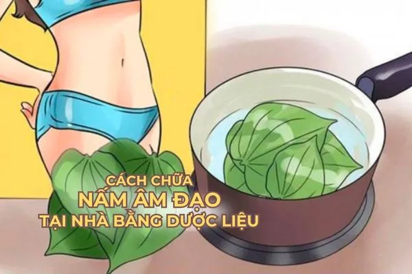 Chị em thường dùng mẹo dân gian và dược liệu để chữa nấm âm đạo