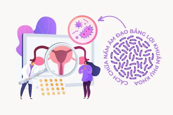 Lợi khuẩn phụ khoa là cách mới nhưng rất hiệu quả để chữa nấm âm đạo