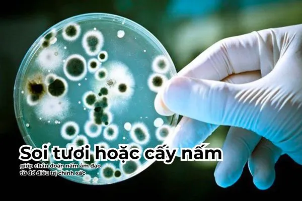 Thuốc kháng nấm được sử dụng để điều trị sau khi chẩn đoán nấm âm đạo