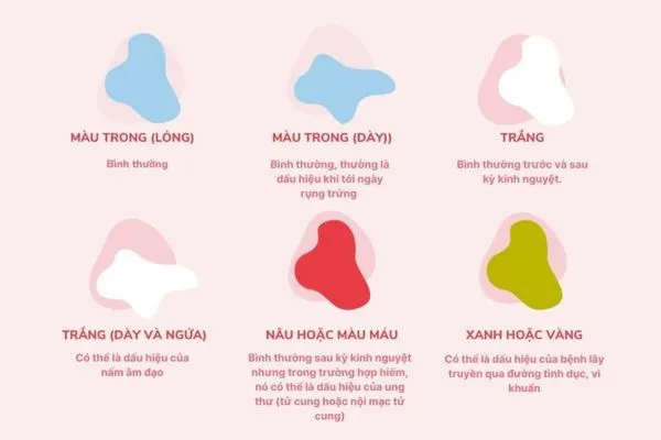 Đặc điểm của khí hư có thể là dấu hiệu cảnh báo