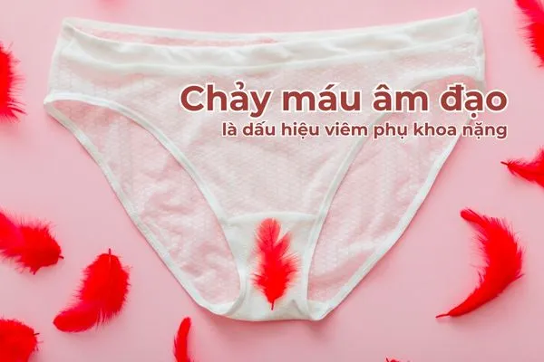 Âm đạo thường bị chảy máu khi viêm phụ khoa nặng