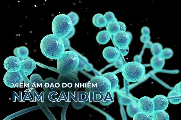 Candida albicans là loại nấm chủ yếu gây bệnh nấm âm đạo