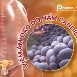Viêm âm đạo do nấm
