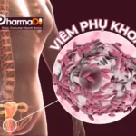 viêm phụ khoa