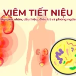 viêm tiết niệu