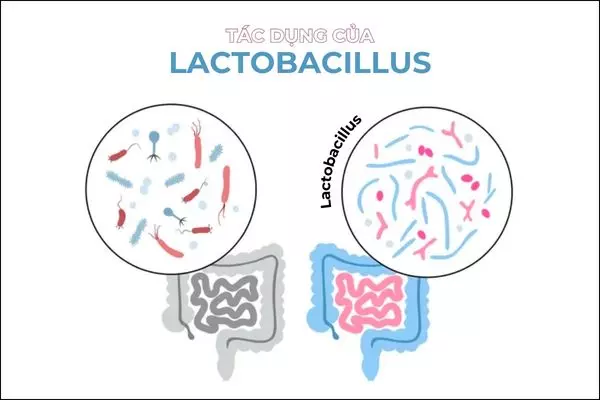 Lợi khuẩn giúp xây dựng hệ vi sinh khỏe mạnh và phòng ngừa viêm nhiễm phụ khoa