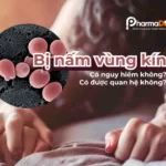 Bị nấm vùng kín thumb