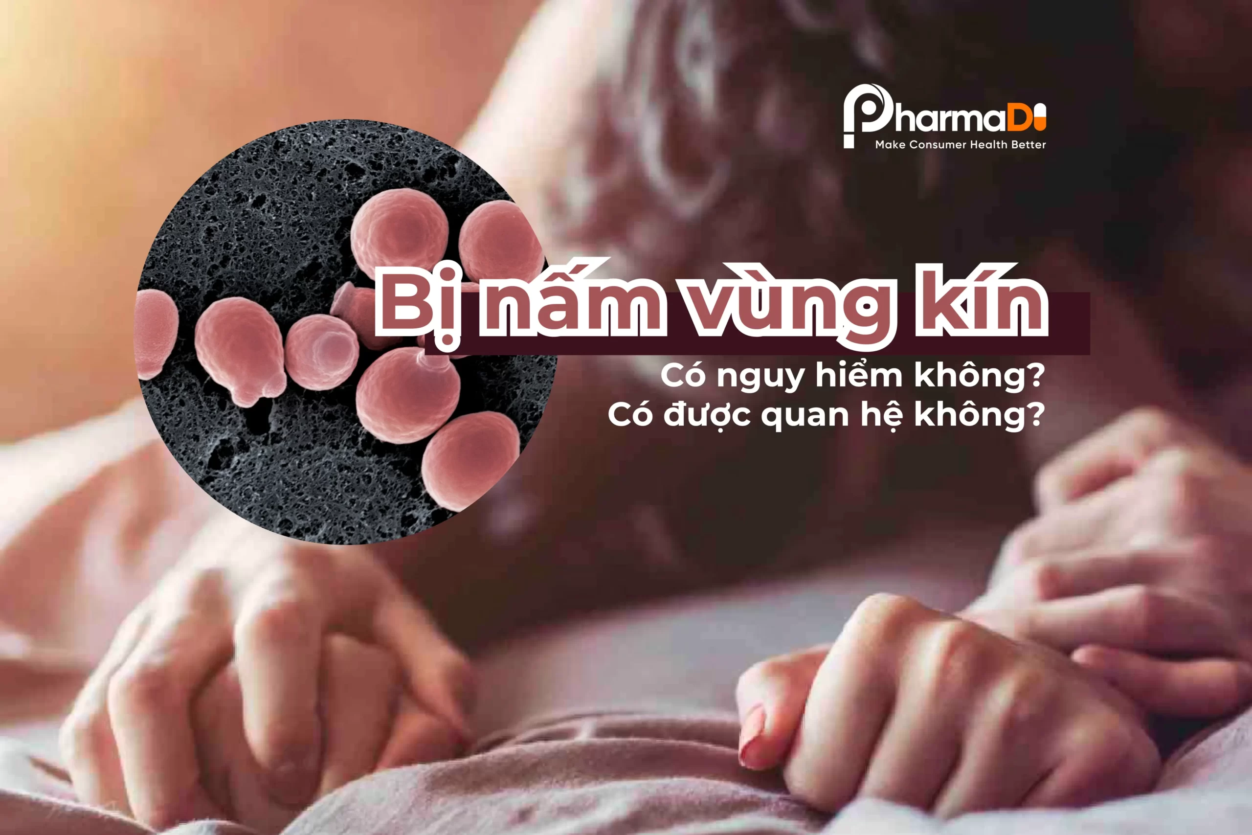 Bị nấm vùng kín thumb