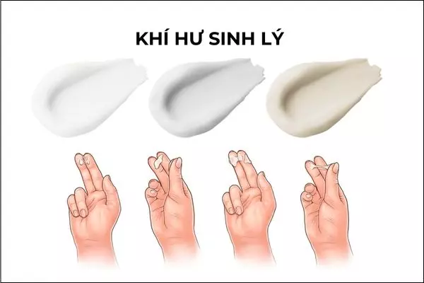 Khí hư sinh lý là dịch tiết âm đạo liên quan đến nồng độ hormone nữ