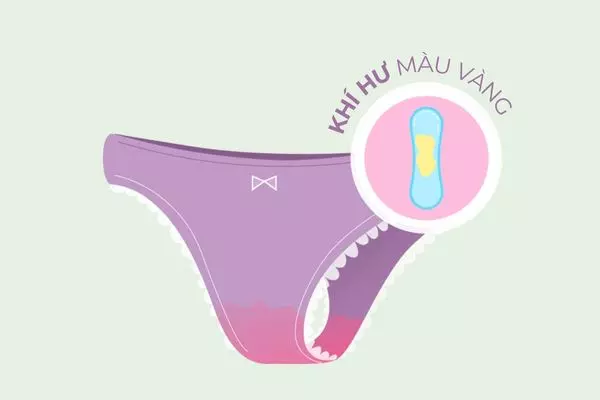 Nhiễm khuẩn thường khiến khí hư ngả sang màu vàng