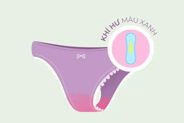 Khí hư màu xanh cũng là dấu hiệu thường thấy ở nhiễm khuẩn lây qua đường tình dục