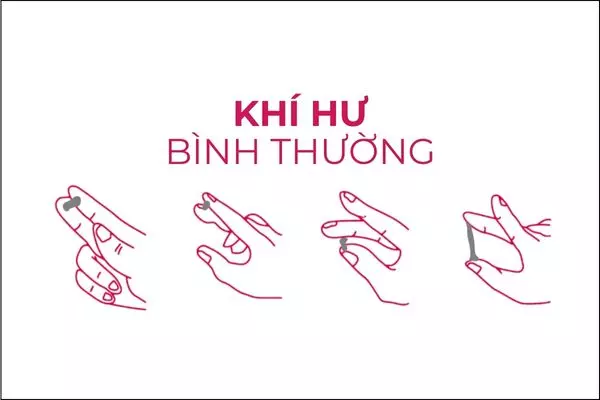 Khí hư bình thường là dịch tiết âm đạo thay đổi theo chu kỳ sinh lý