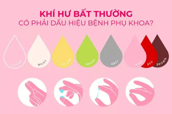 Dịch tiết âm đạo có thể thay đổi về màu sắc, kết cấu, mùi hương do bệnh phụ khoa