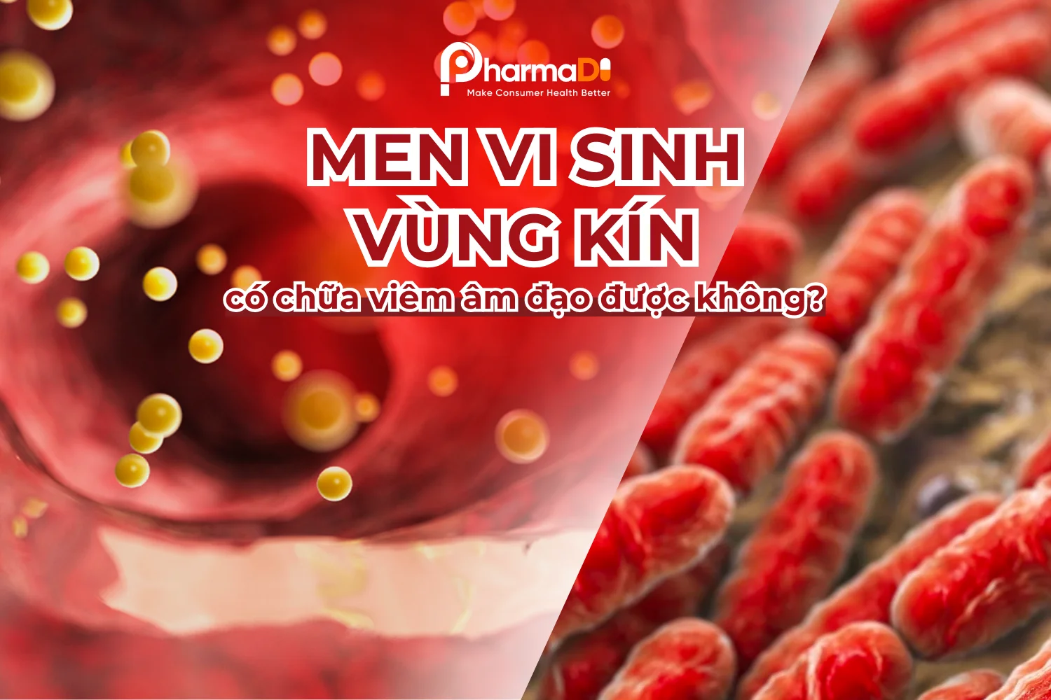 Men vi sinh vùng kín chữa viêm âm đạo