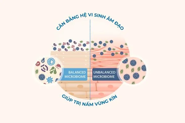 Thực hiện các biện pháp tiêu diệt nấm và tăng lợi khuẩn giúp điều trị nấm vùng kín