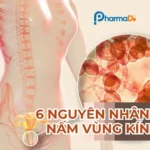 Nguyên nhân bị nấm vùng kín