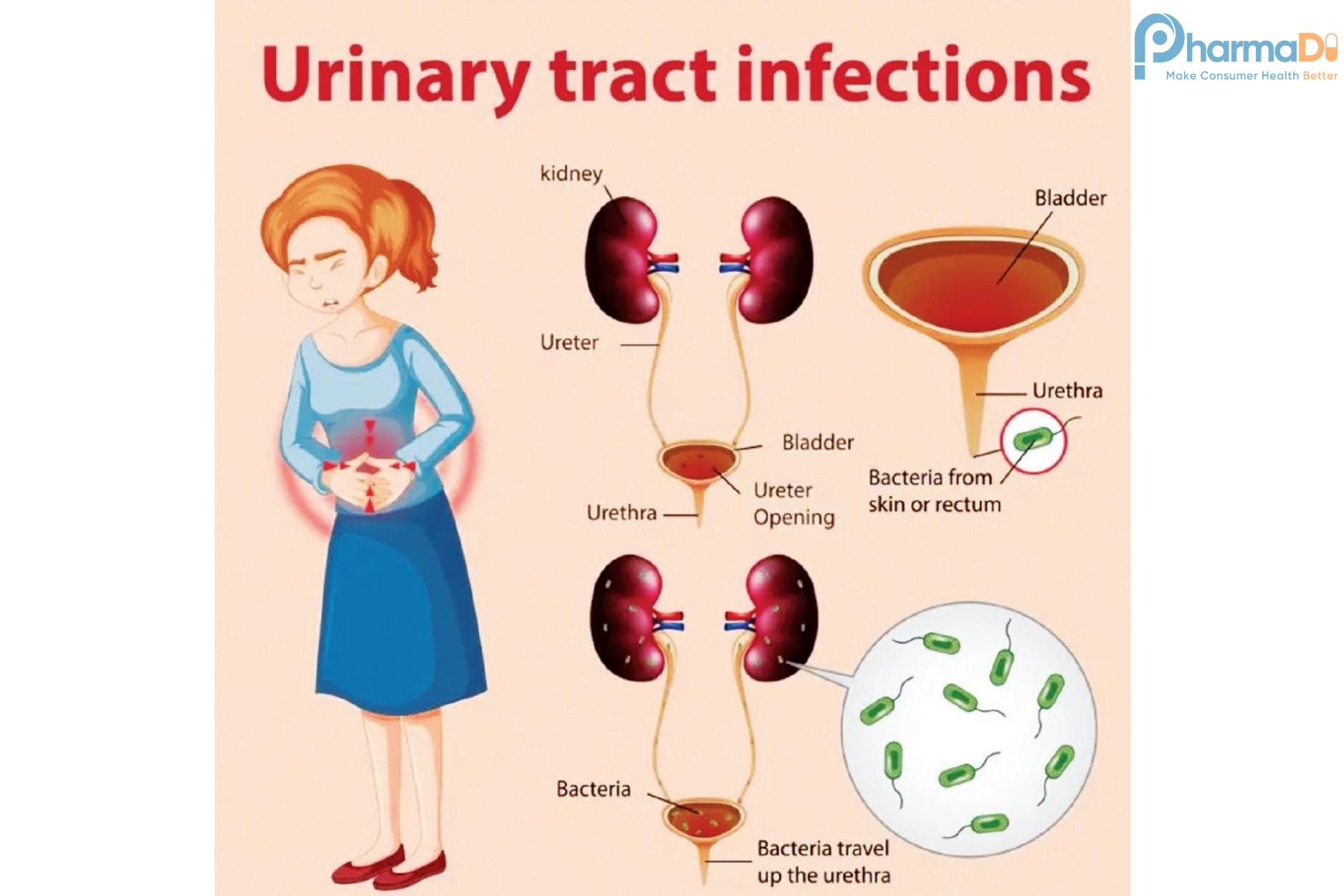 Nhiễm Khuẩn Tiết Niệu Và Những điều Lưu ý