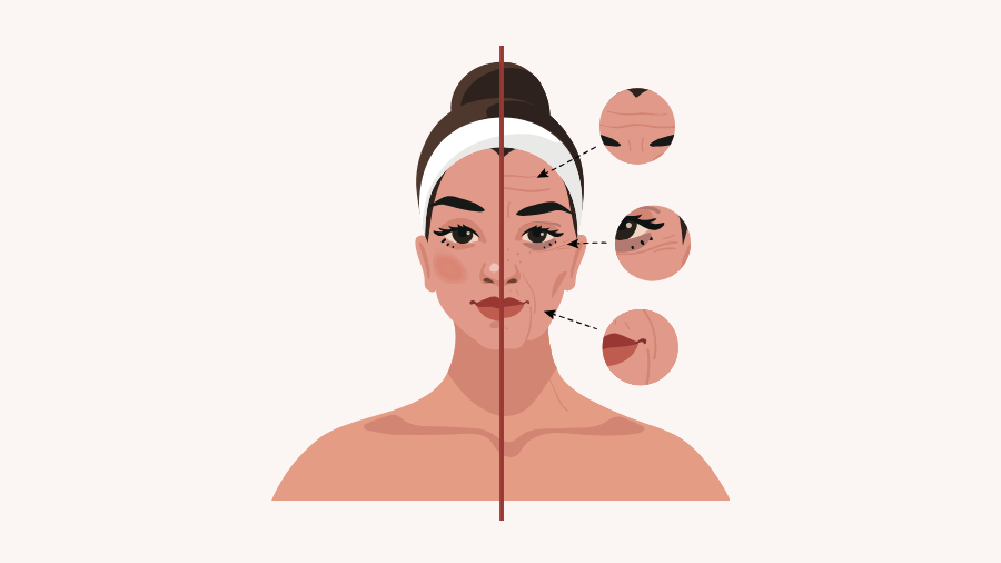 Khi lượng estrogen giảm, các dấu hiệu lão hóa như da nhăn, nám, cơ thể chảy xệ