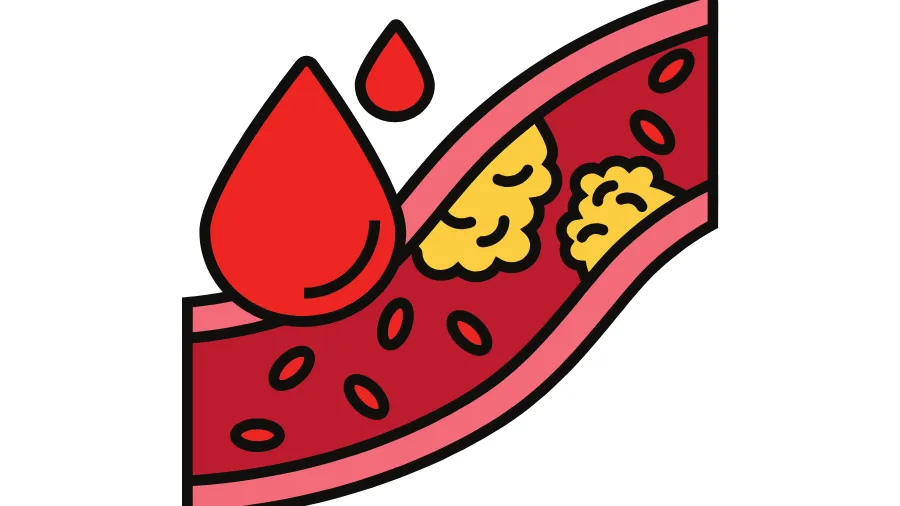 MỠ MÁU CAO? ĐỪNG LO, OMEGA – 3 SẼ GIÚP BẠN